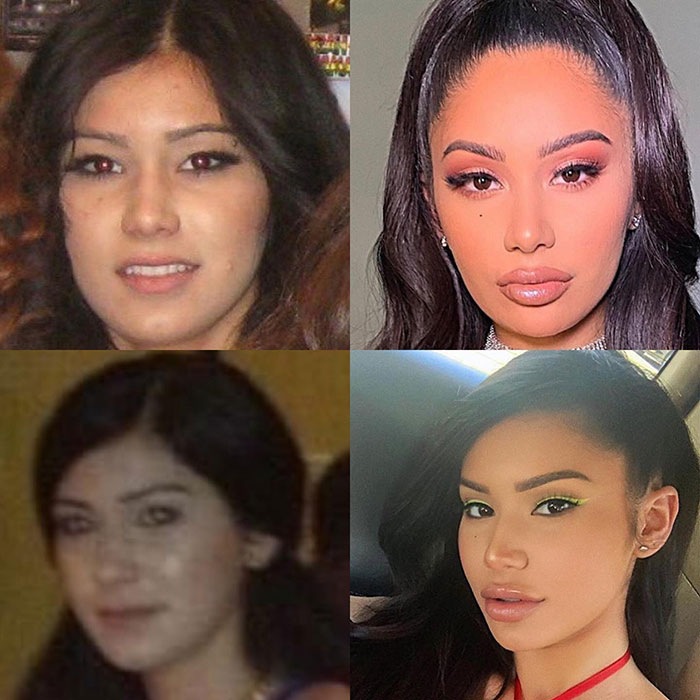 Janet guzman before and after