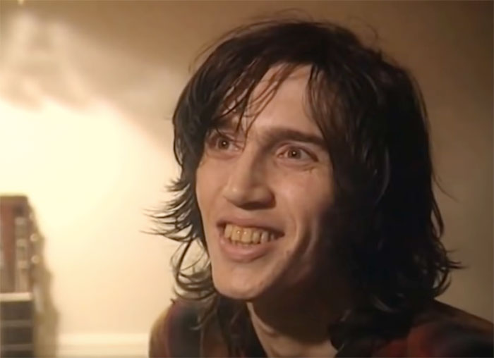 John Frusciante teeth